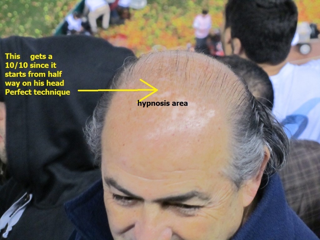 hypnosis forehead